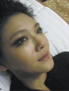 明星网红扎针灸疼痛大哭