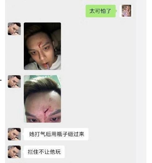 网红今日份瓜你吃了没